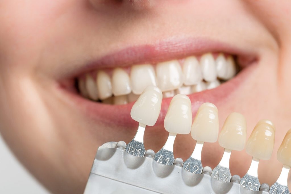 Boost Your Dental Practice with Orthodontic SEO